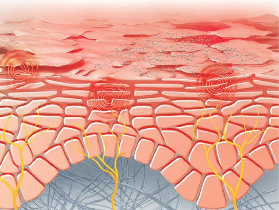 Skin graphic